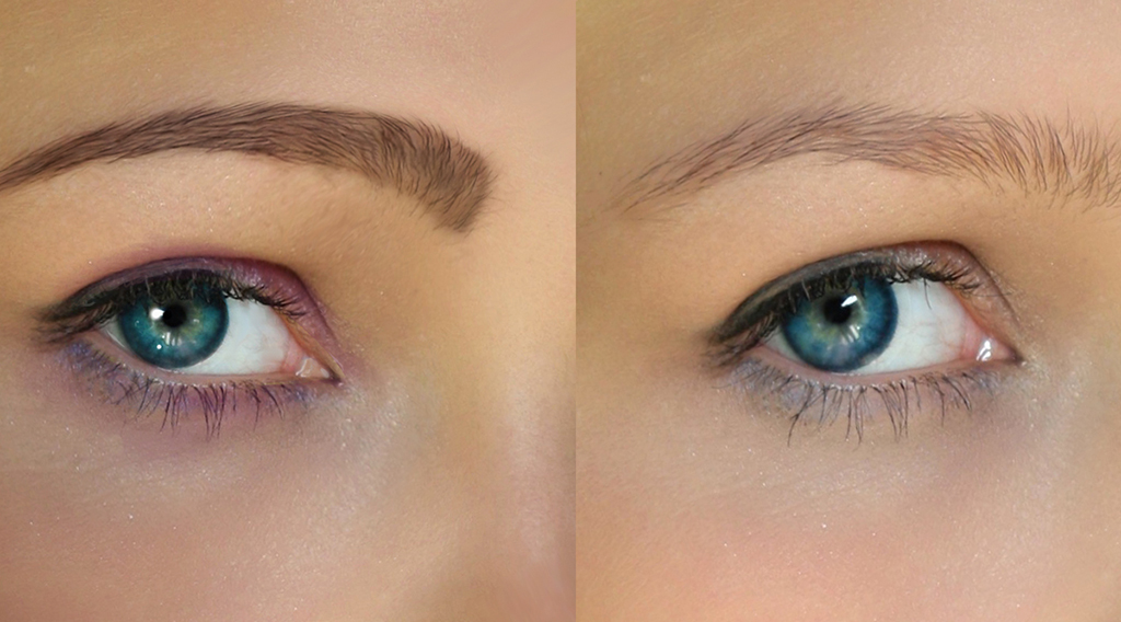 Before After Treatment PMU removal eyebrow photos